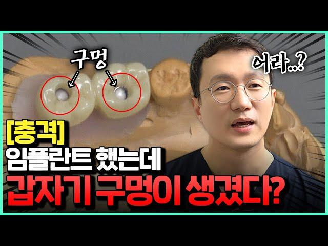 임플란트 후 갑자기 치아에 생긴 구멍의 정체