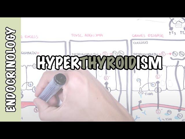 Hyperthyroidism Overview (causes, pathophysiology)