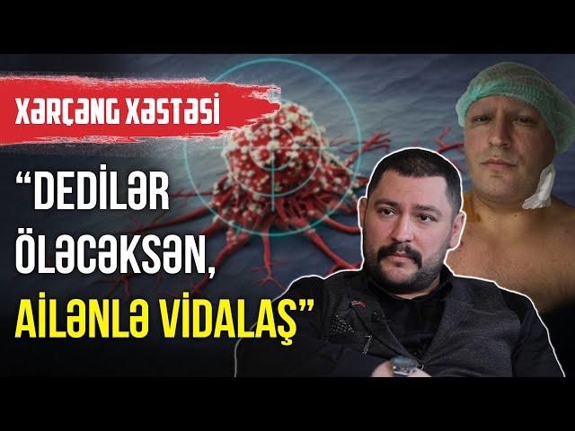 Xərçəng xəstəsi: Dedilər yaşamayacaqsan, ailənlə vidalaş - ARZUNUN VAXTI | BAKU TV