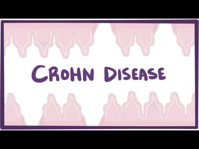 Crohn's disease (Crohn disease) - causes, symptoms & pathology