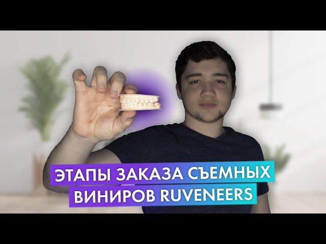 КАК ЗАКАЗАТЬ ИНДИВИДУАЛЬНЫЕ СЪЕМНЫЕ ВИНИРЫ | ЭТАПЫ ПОКУПКИ РУВИНИРОВ | КУПИТЬ НАКЛАДКИ | RUVENEERS