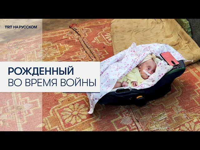 Из-за израильских авиаударов палестинский младенец родился с патологией мозга