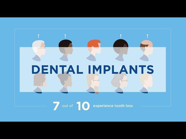 Dental Implants: Long-term Solution (1:09)