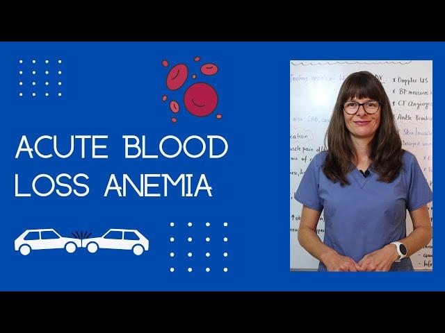 Acute Blood Loss Anemia