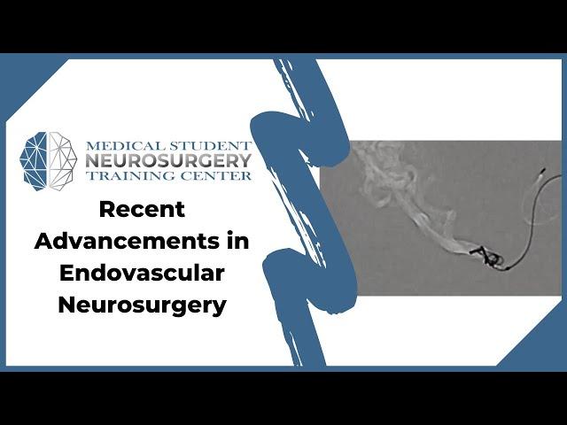 Recent Advancements in Endovascular Neurosurgery