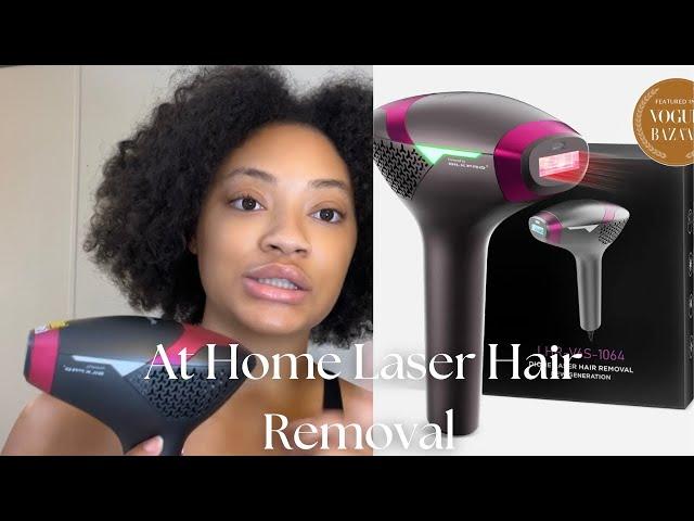 Dermrays At Home Laser Removal Review