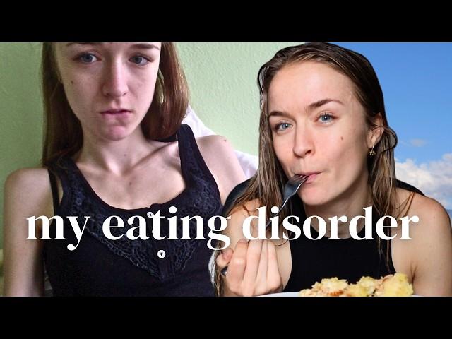 MY 6 YEAR EATING DISORDER RECOVERY STORY | Anorexia and Orthorexia Journey