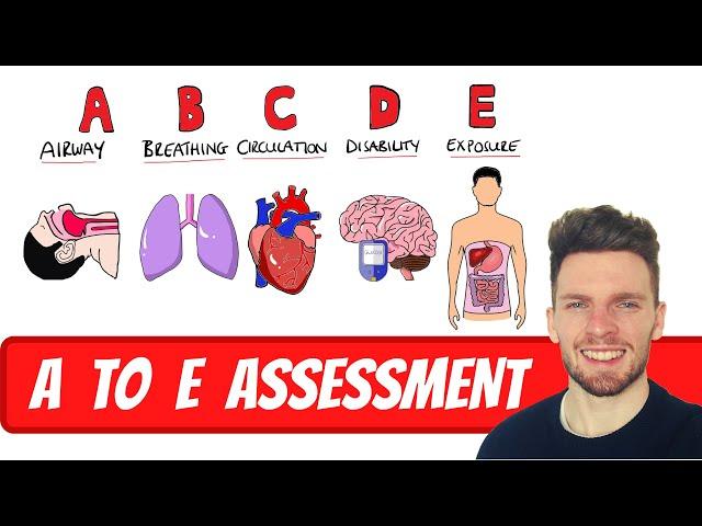 A to E Assessment for Deteriorating and Acutely Unwell Patients | ABDCE Clinical Approach