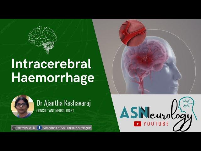 Intracerebral Haemorrhage by Dr Ajantha Keshavaraj