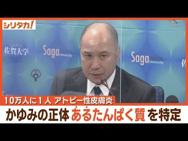 アトピー性皮膚炎　かゆみの正体を解明　佐賀大学