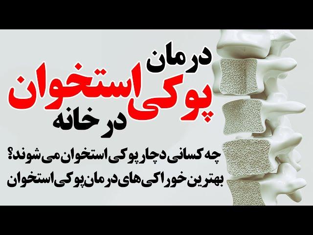 بهترین خوراکی ها برای درمان پوکی استخوان در خانه با طب سنتی