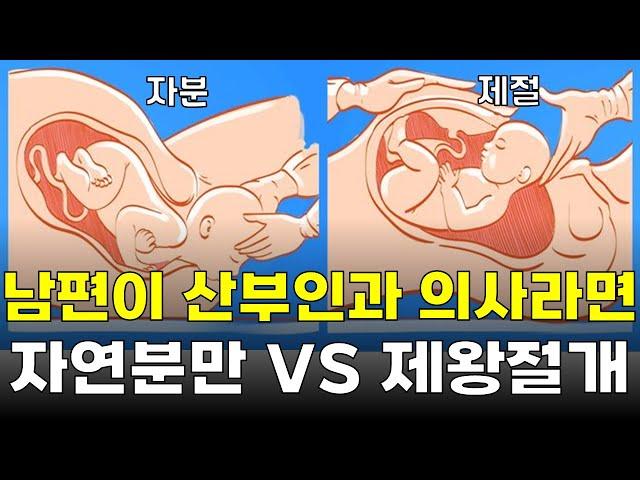 남편이 산부인과 의사라면 자연분만할까 제왕절개할까?