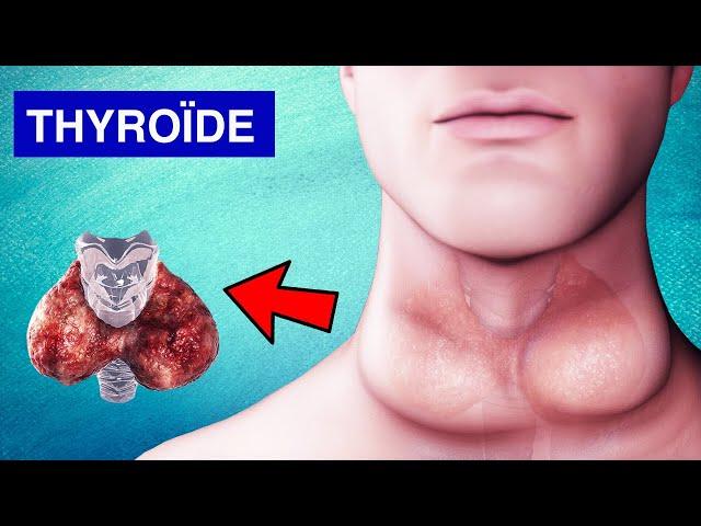 Glande Thyroïde : Pathologies, Symptômes et Traitements