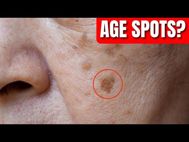 How APPLE CIDER VINEGAR Remove AGE SKIN SPOTS?