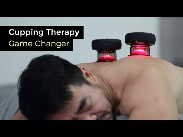 Introducing Achedaway Cupper - Cupping Therapy Game Changer