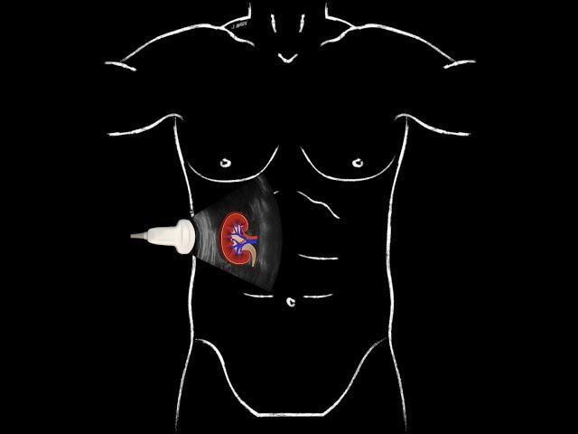 POCUS -  Basic Renal Ultrasound