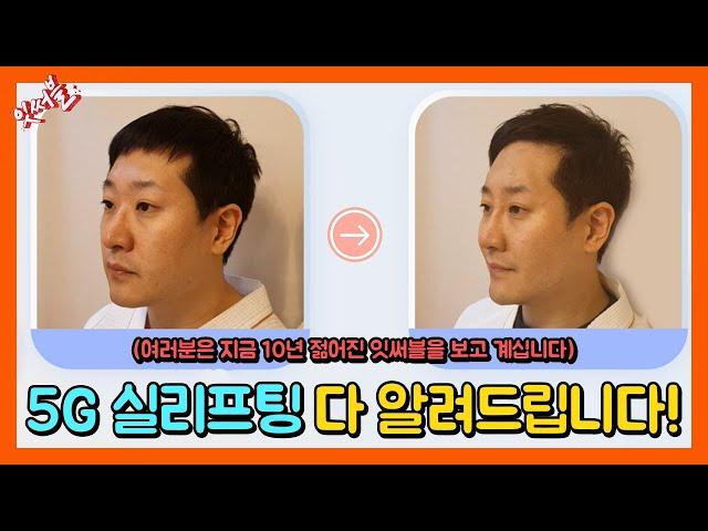 잇써블 5G 실리프팅 체험하다! 풀페이스(팔자필러, 턱필러 등) 콜라겐 필러 유스필 후기까지!