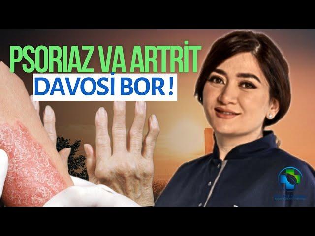 PSORIAZ VA ARTRİT DAVOSI BOR! | Protokol koimbra | Doctor Dilobar