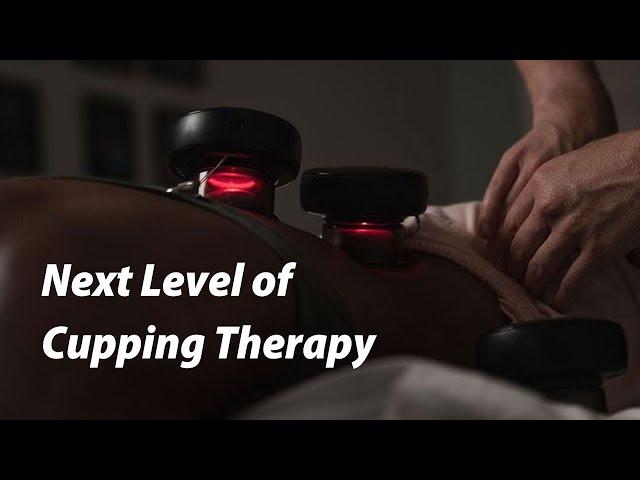 OMG ! The Best CUPPING THERAPY Ever !