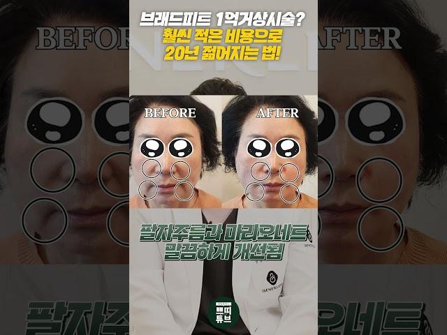 브래드피트 1억거상시술? 훨씬 적은 비용으로 20년 젊어지는 법(feat.일산실리프팅)