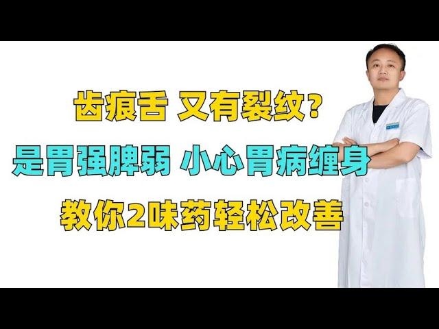 齿痕舌又有裂纹？是胃强脾弱，小心胃病缠身，教你2味药轻松改善