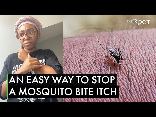 Mosquito Bite? Here's A Black Hack That'll Stop the Itch