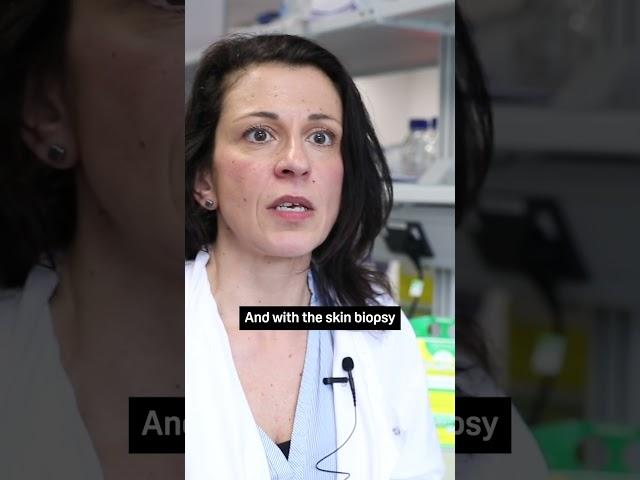 Stroke in young adults: Dr Alessandra Granata #Stroke #StrokeAwareness #Shorts