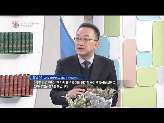 한국경제TV 굿 닥터스 - "루푸스" 경북대학교병원 류마티스내과 강영모교수님편