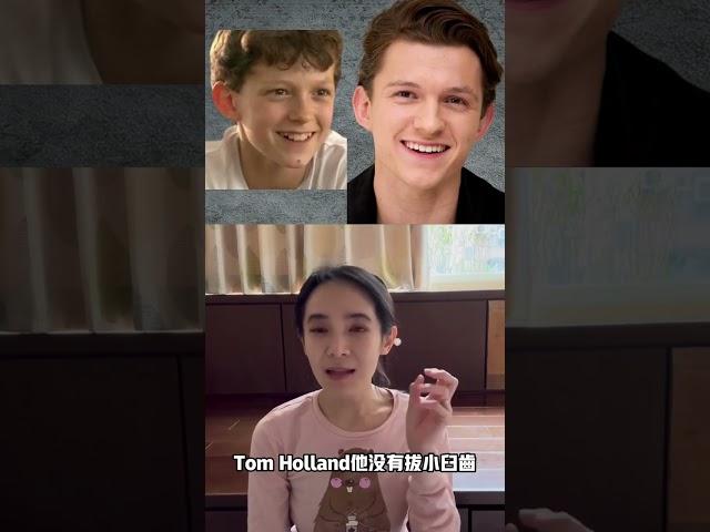 拔牙矯正後悔了嗎？也許看了這部影片你會改觀。美國隊長PK蜘蛛人，拔牙矯正vs不拔牙矯正｜林榆芩醫師