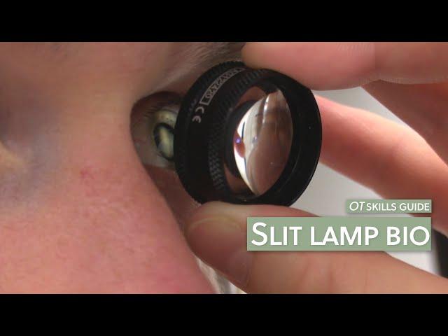 OT skills guide: Slit lamp bio