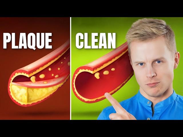 Clear Plaque From Arteries Naturally with This Protocol