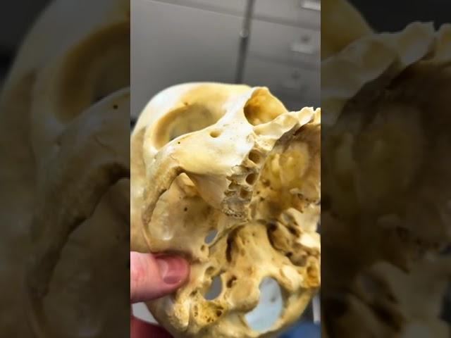 REAL Human Skull