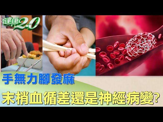 手無力腳發麻 是末梢血循差還是神經病變? 健康2.0