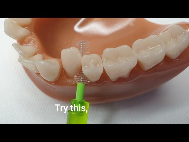 Cleaning between teeth - something for everyone!