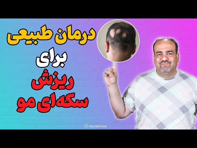 درمان طبیعی برای ریزش سکه‌ای مو