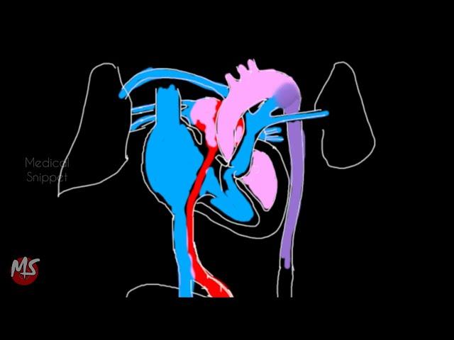 Fetal Circulation | Anatomy | Made easy | 3 minutes