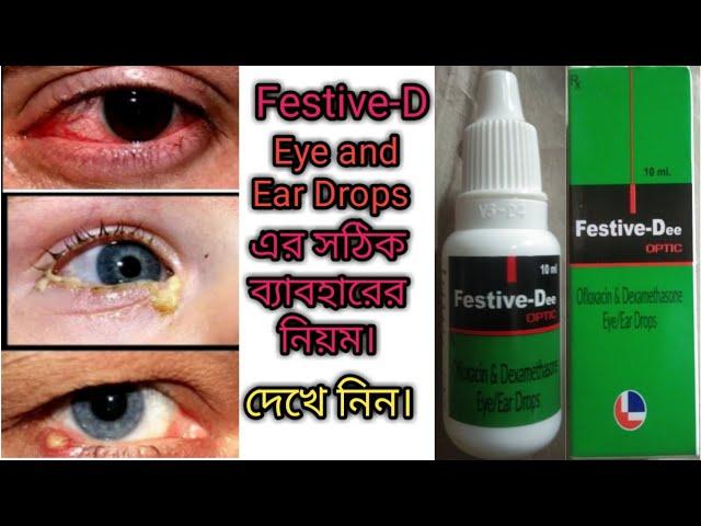 Festive-Dee এর ব্যবহার মাত্রা এবং পার্শ্ব প্রতিক্রিয়া সম্পূর্ন বাংলায়।#Rajbangshi medical.