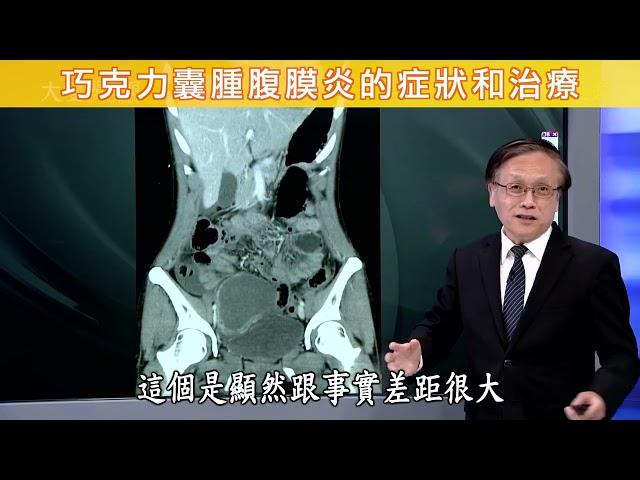 【巧克力囊腫腹膜炎的症狀和治療】【大愛醫生館精選】