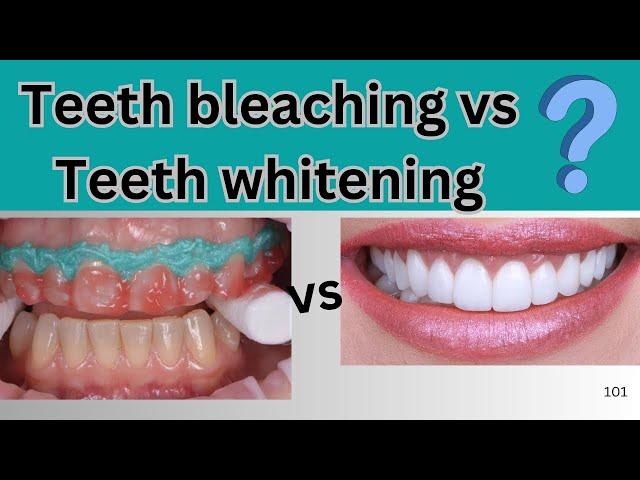 teeth bleaching vs teeth whitening  | Dr Rohan Virani