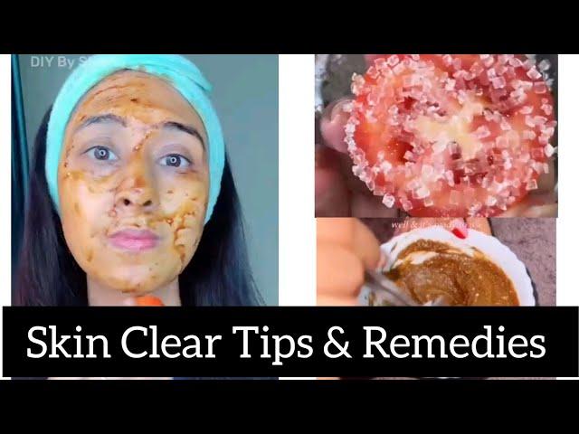 skin whitening tips// home remedies for Skin Care Tips #styleofyourlife