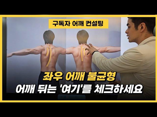 [구독자 어깨 컨설팅] 어깨 불균형으로 인한 어깨 통증