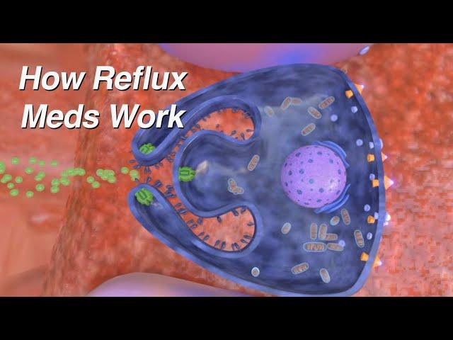 How do Reflux Medications Work (Proton Pump Inhibitors, H2 Blockers, Alginates)