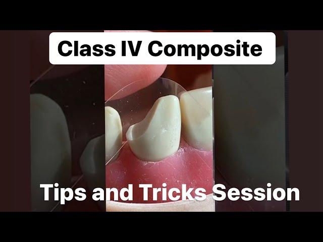 Class IV Composite Tips and Tricks session