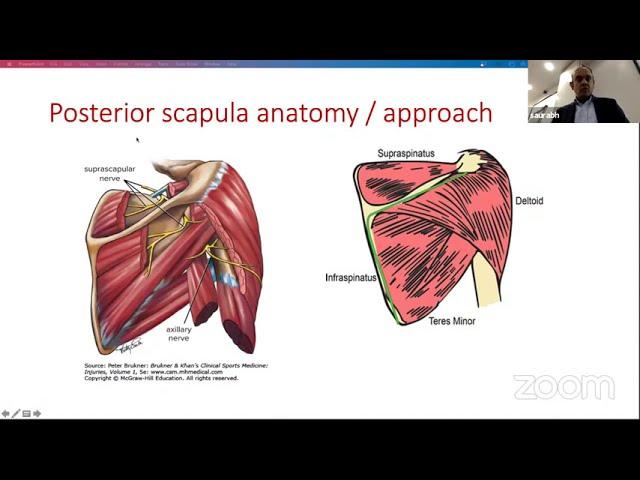 Orthopaedic Principles, London Upper Limb FRCS Course