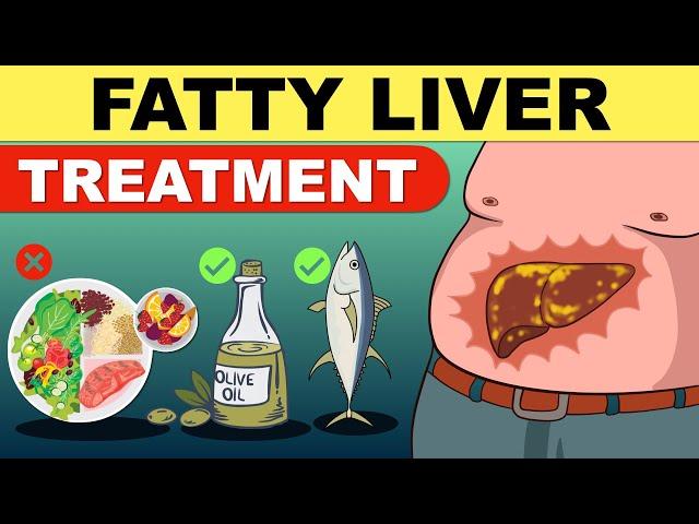 Fatty Liver Treatment | Fatty Liver Diet | Liver Detox | Fatty Liver | Fatty Liver Symptoms