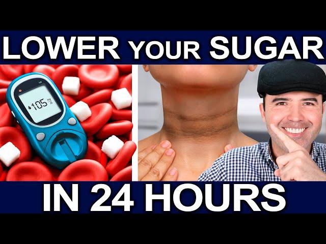 HOW TO DETROY SUGAR AND ELIMINATE DIABETES IN 5 STEPS - REVERSE HIGH BLOOD SUGAR