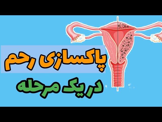 سلامت رحم / بدون جراحی سلامت رحم ات رو تضمین کن #سالیک  #زنان