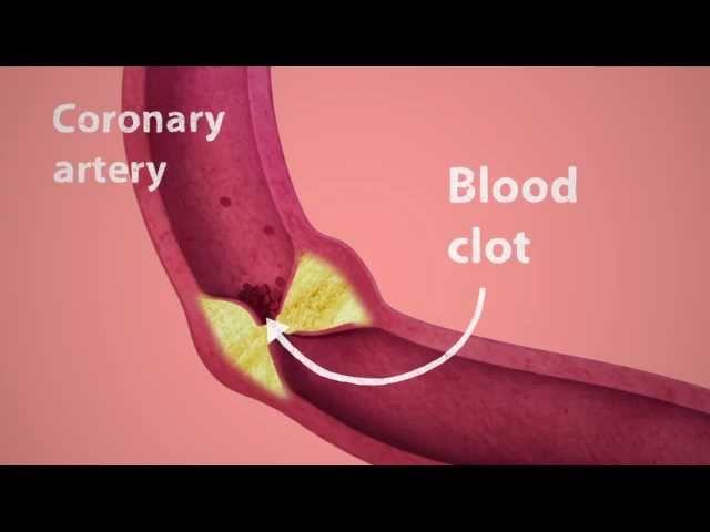 British Heart Foundation - How do you mend a broken heart?