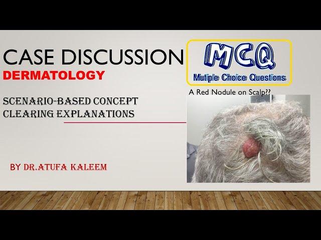 Case Discussion |Dermatology | Practice Questions | Dr Atufa Kaleem | epidermal nevus | medical