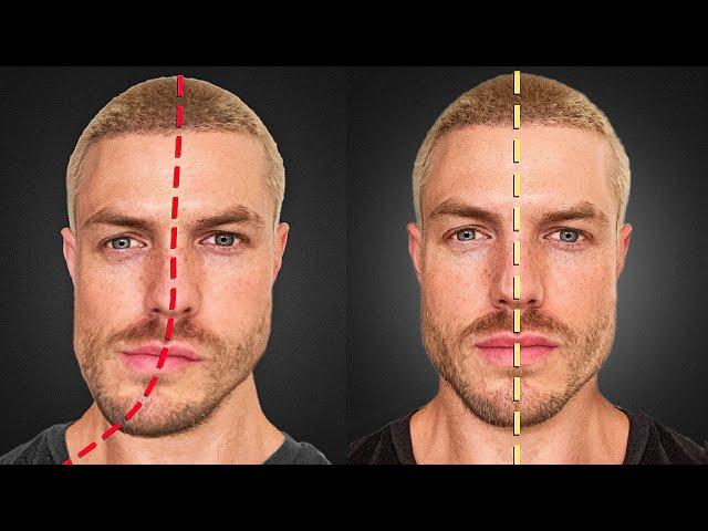 How to Fix Jaw & Face Asymmetry (FOREVER)